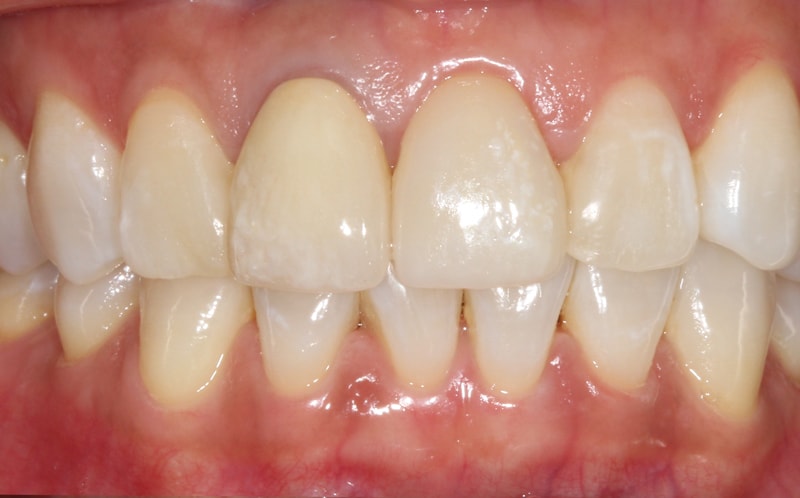 Comsetic-treatment.-after-01