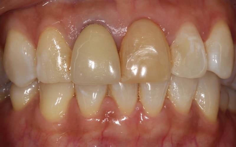 Comsetic-treatment.-before-01