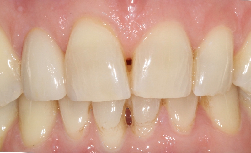 cosmetic-dentist-dulwich-2-a