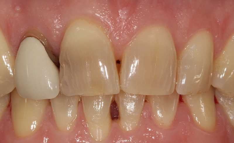 cosmetic-dentist-dulwich-2-b