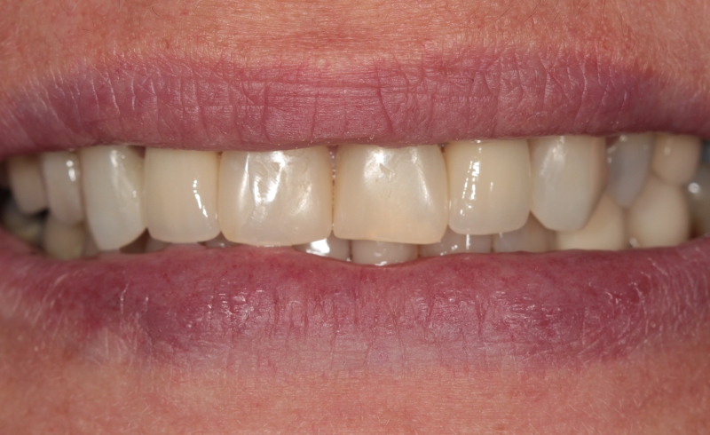 cosmetic-dentist-dulwich-3-a