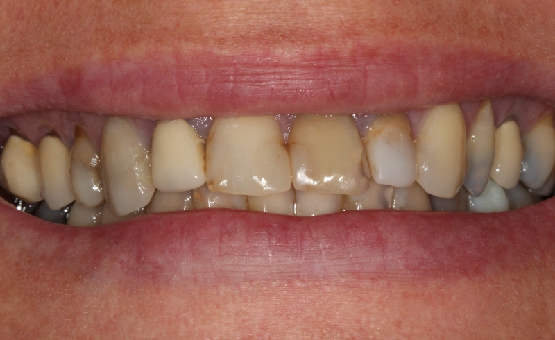 cosmetic-dentist-dulwich-3-b